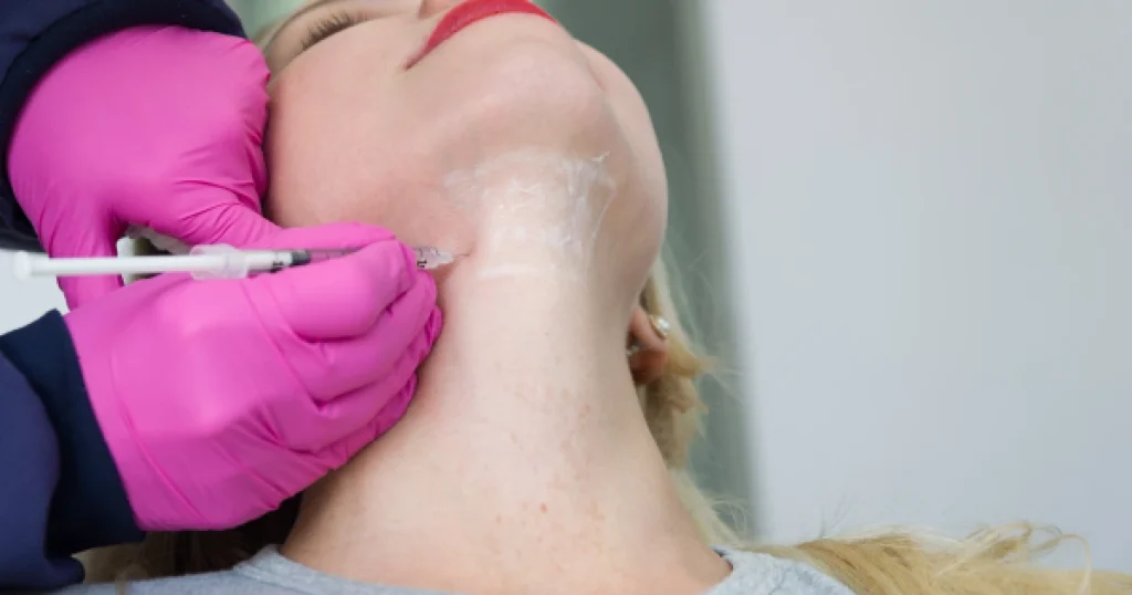 Women Receiving Kybella Treatment in Yukon, OK